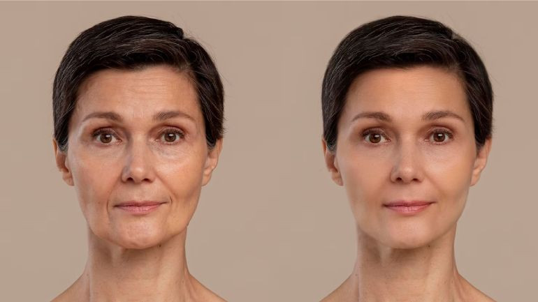 Victoria Face Lift Reviews: Discover How Science Enhances Beauty with Real User Experiences