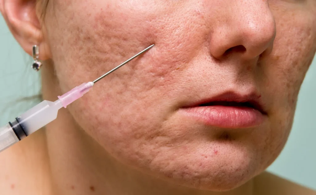 Addressing Deep Skin Scars With Targeted Clinical Treatment Techniques